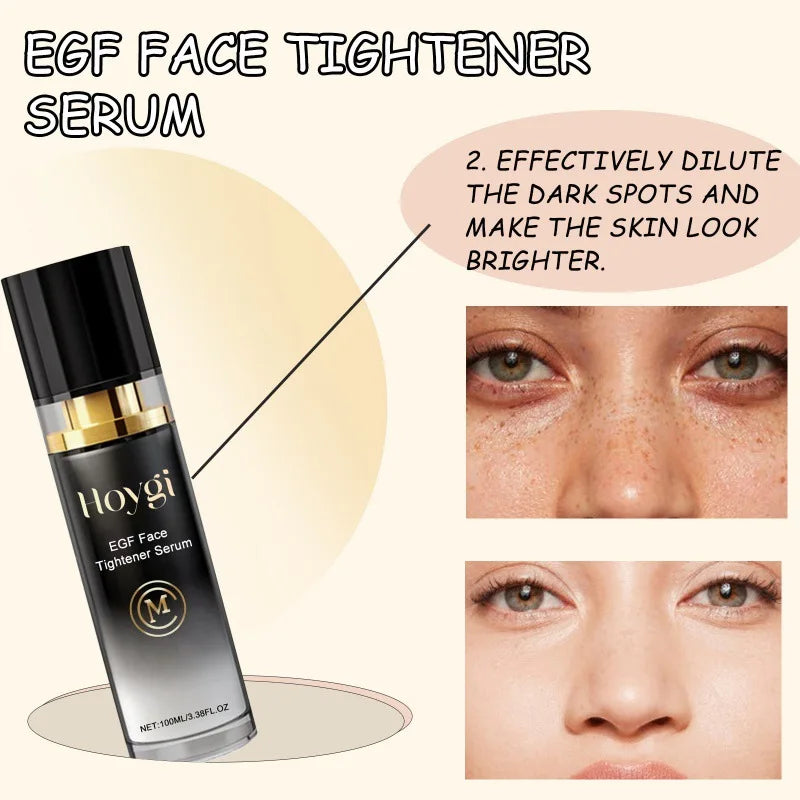 Face Tighten Serum Lighten Dark Spot Fade Fine Lines.