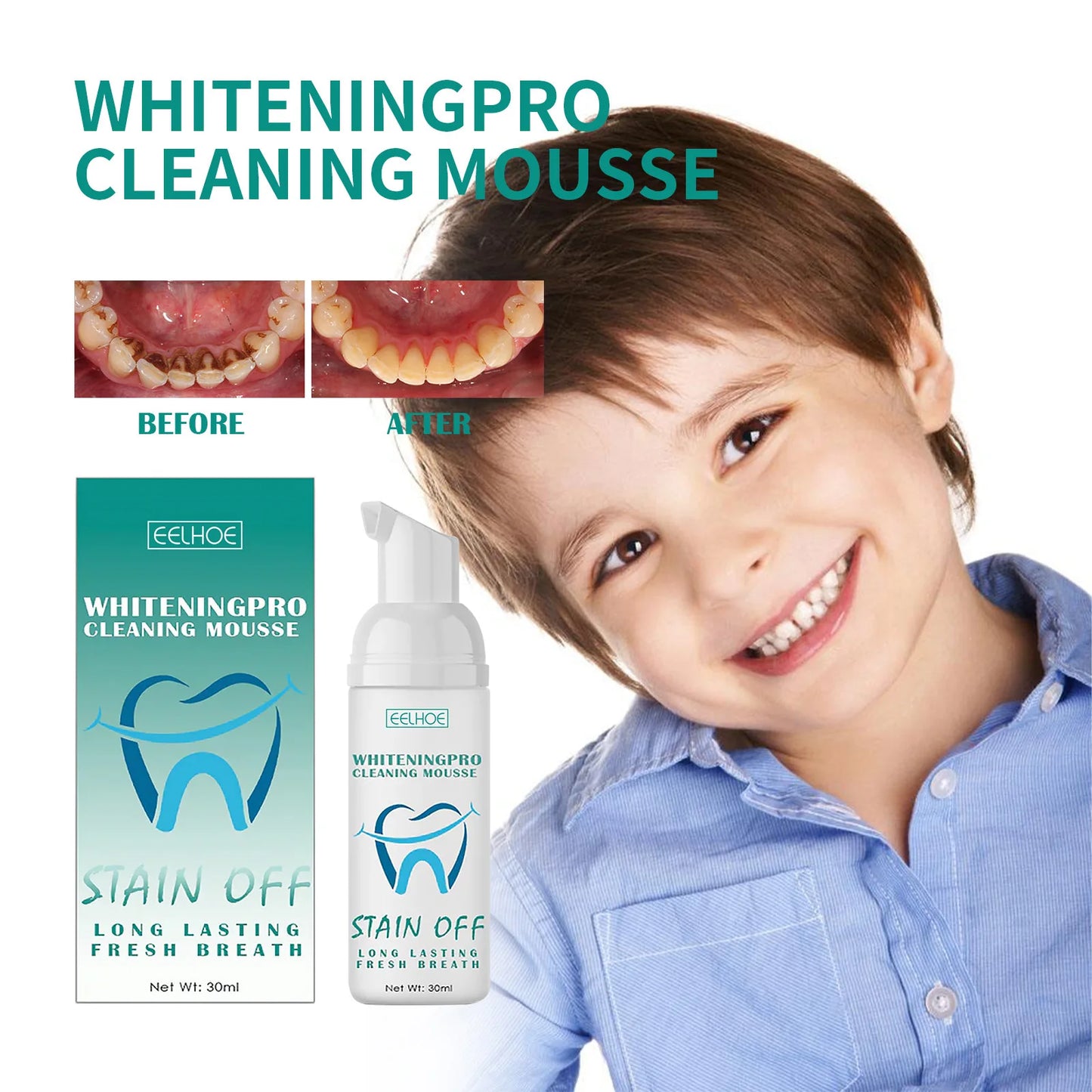 Teeth Whitening Mousse Brightening Yellow Teeth Stain Removal