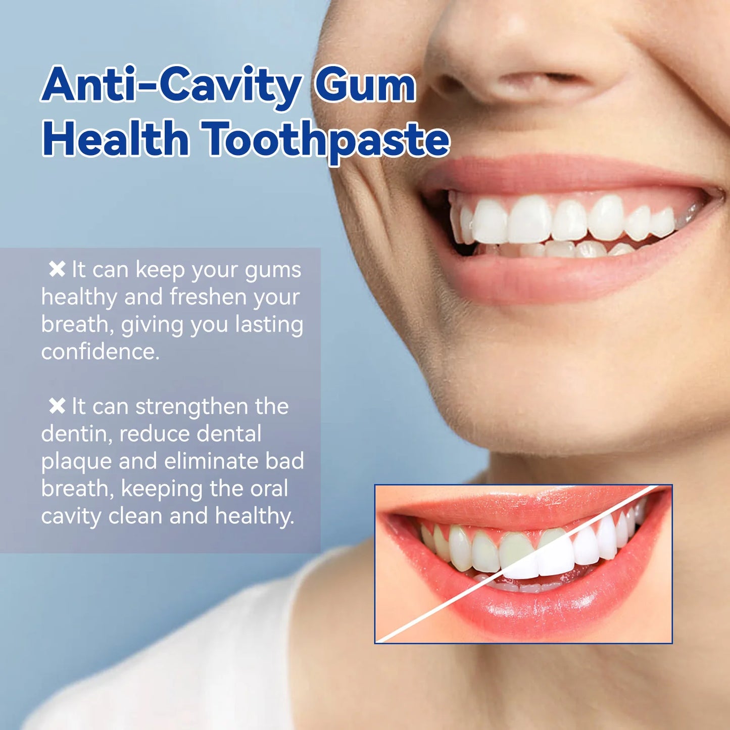 Anti Cavity Teeth Whitening Toothpaste