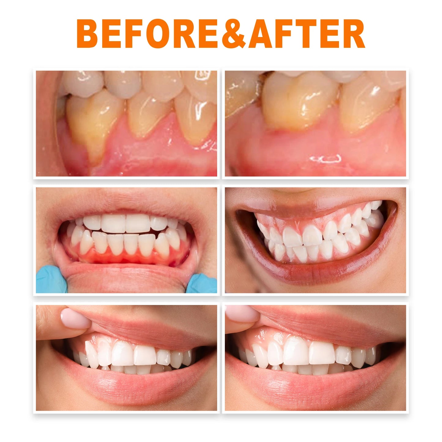 Gum Repair Essence Cleans The Teeth and Protects the Gums