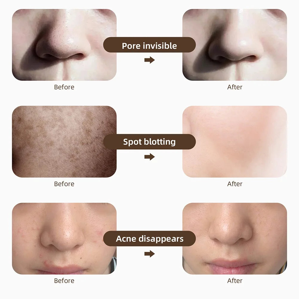 LED Face Neck Mask Skin Rejuvenation Repair