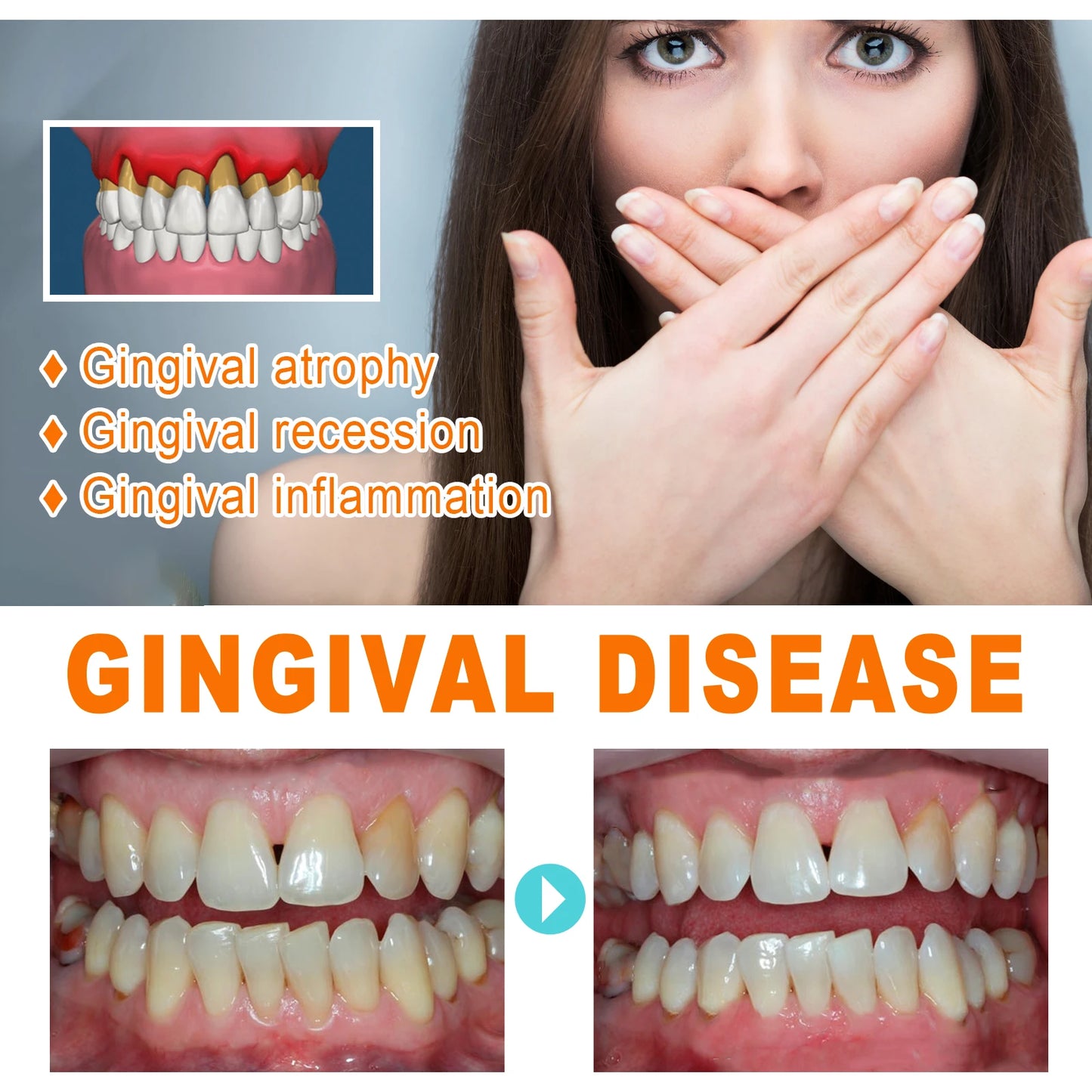 Gum Repair Essence Cleans The Teeth and Protects the Gums