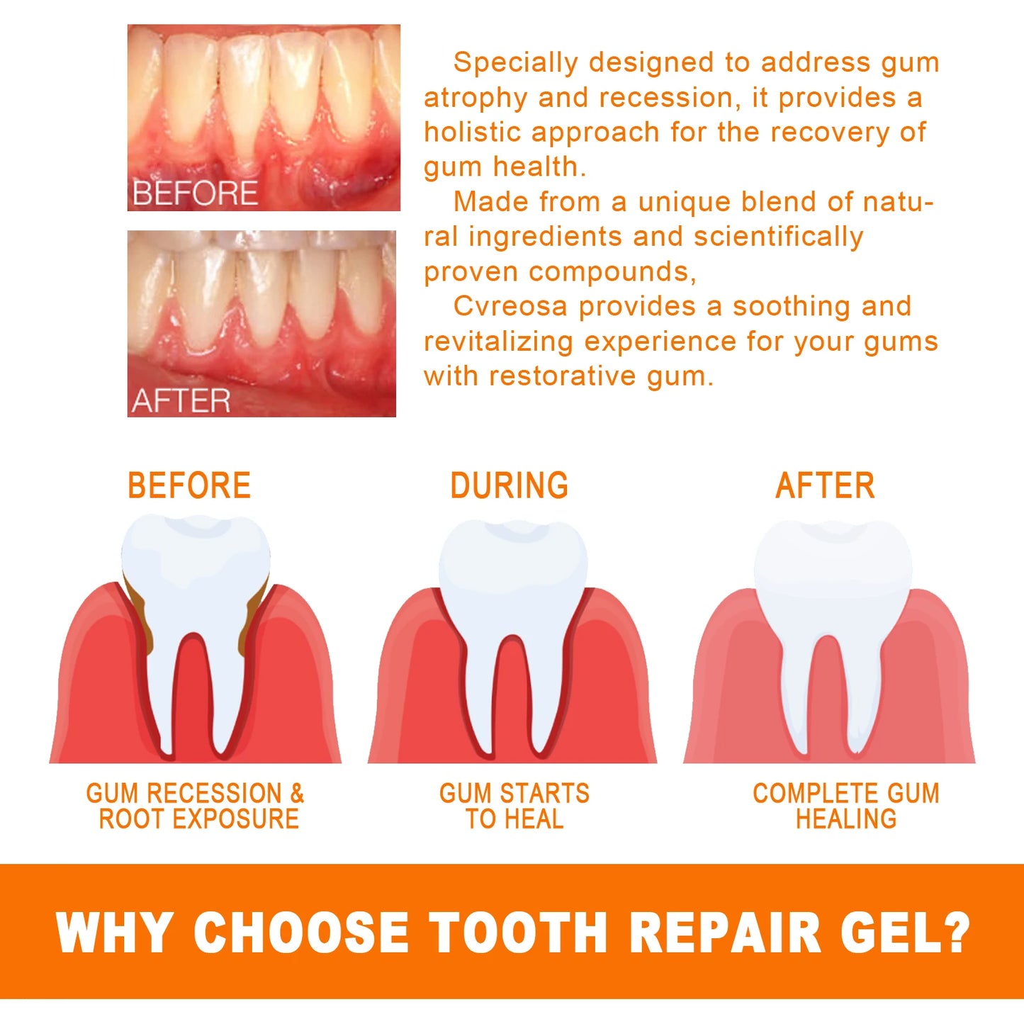 Gum Repair Essence Cleans The Teeth and Protects the Gums