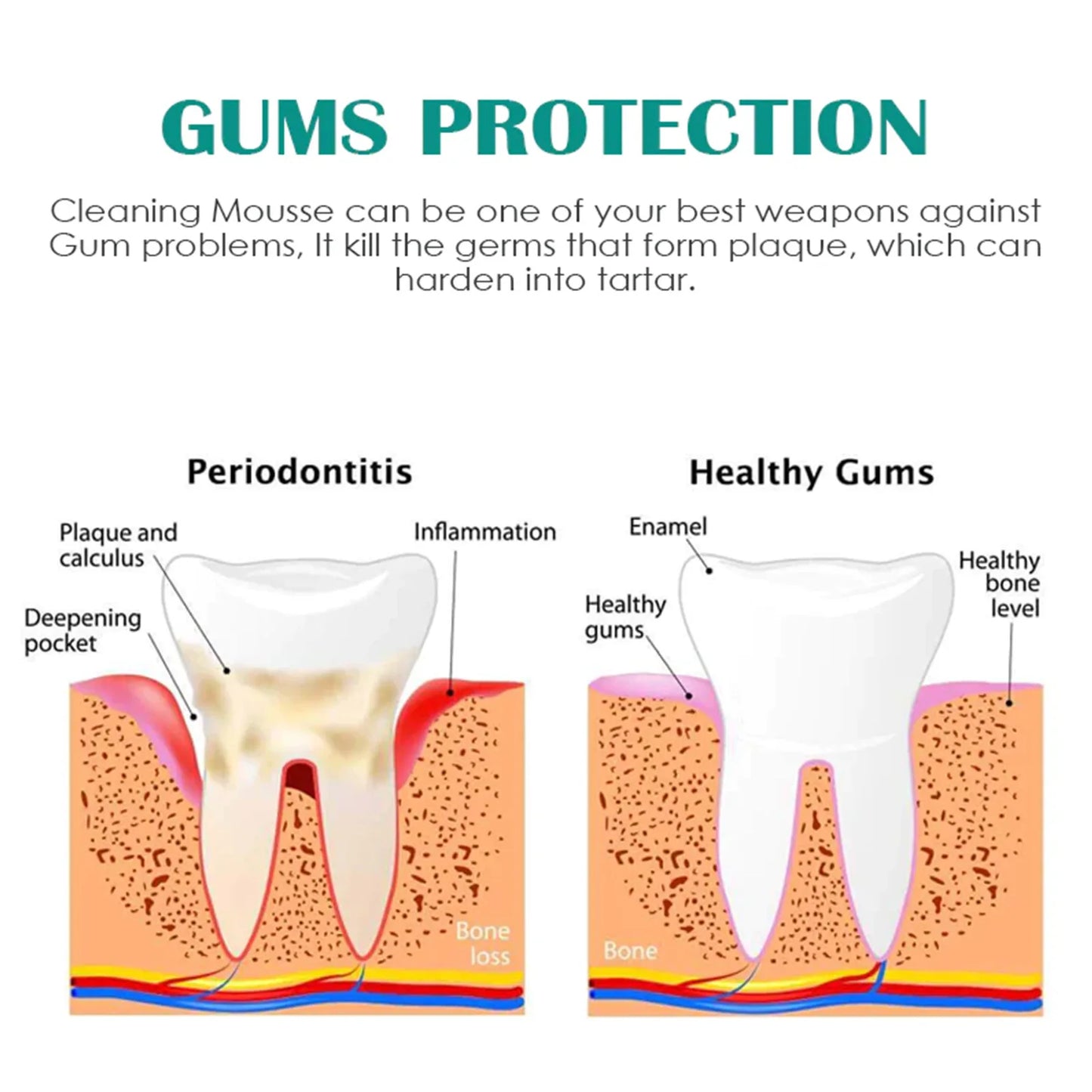 Teeth Whitening Mousse