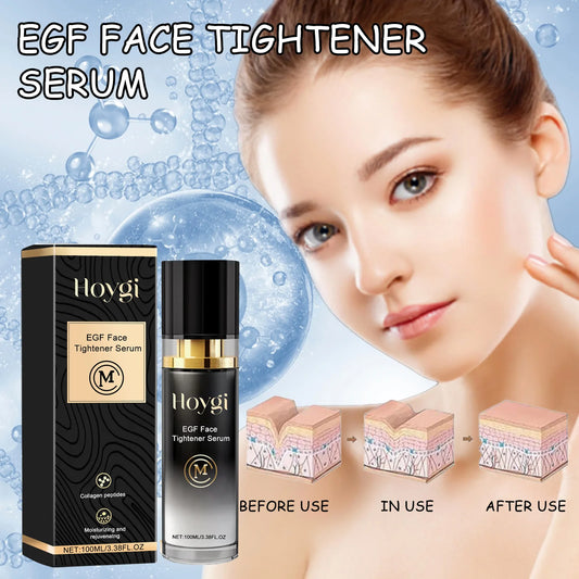 Face Tighten Serum Lighten Dark Spot Fade Fine Lines.