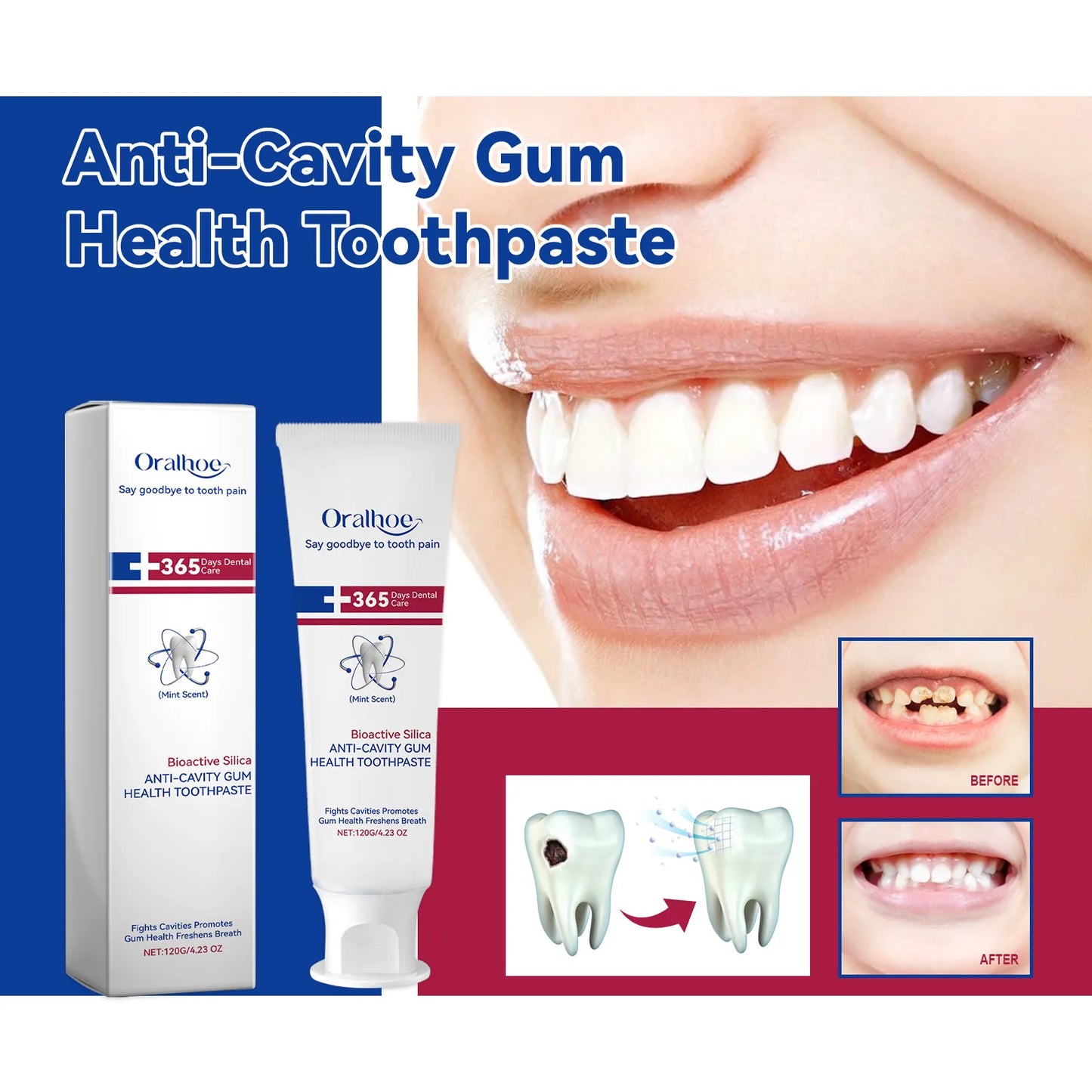 Teeth Whitening Toothpaste