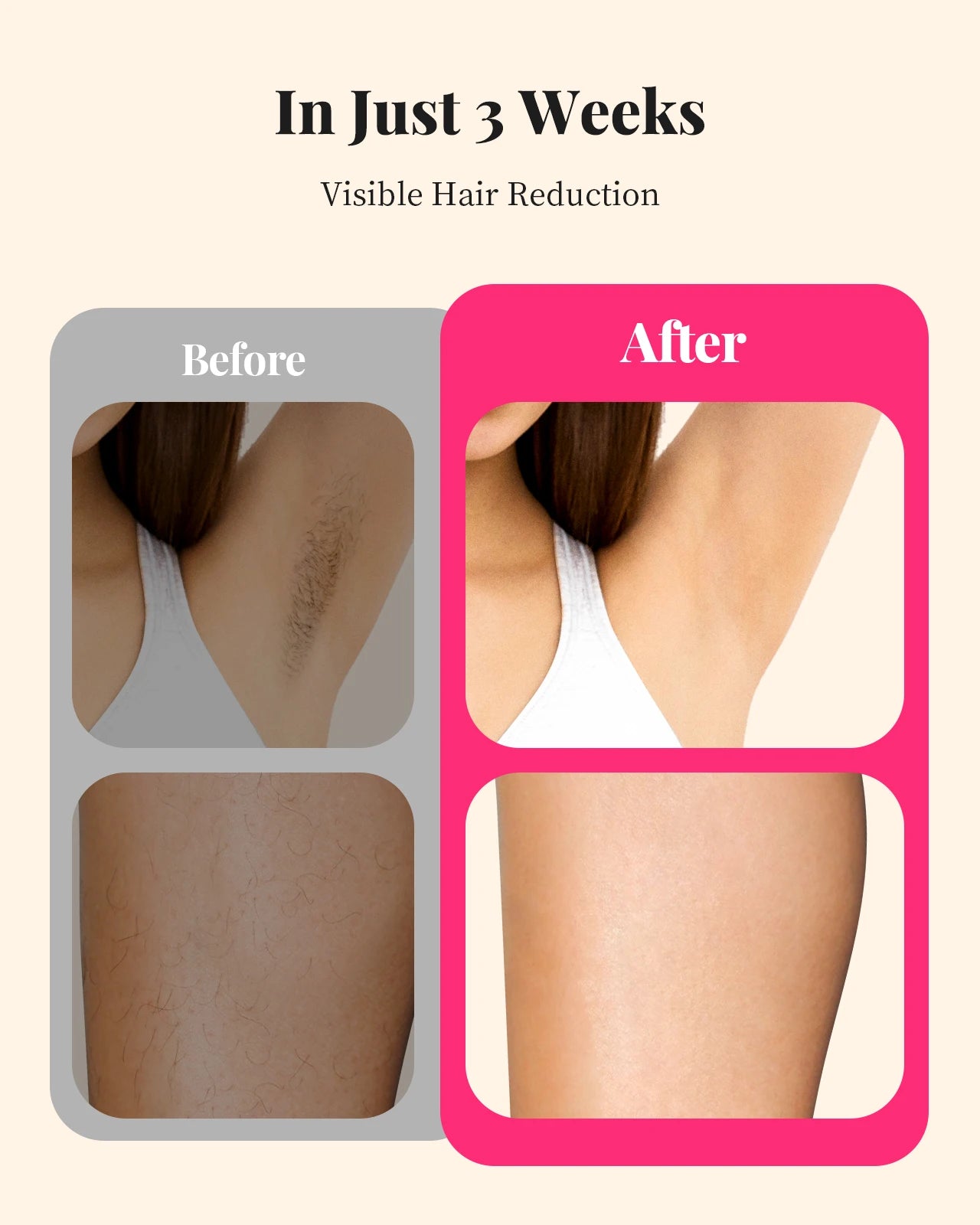 Laser Hair Removal for Women and Men.
l