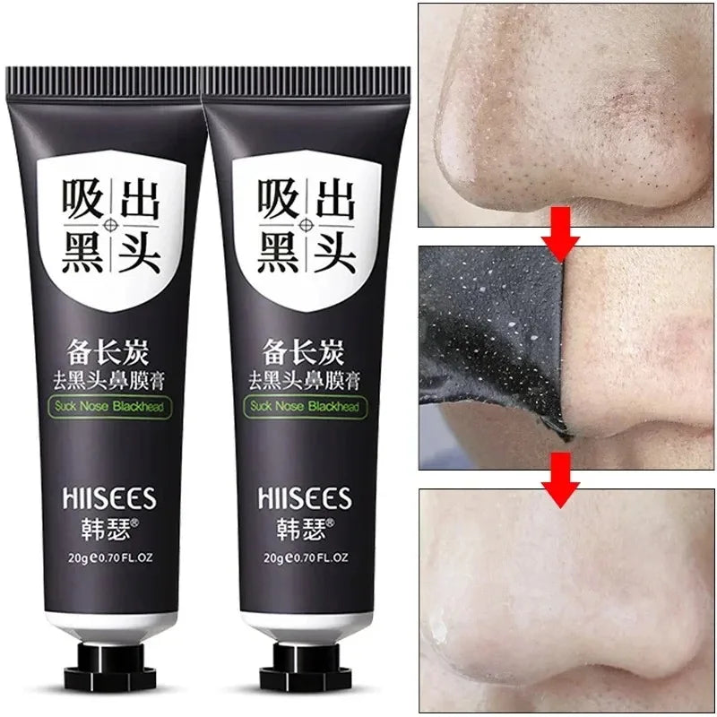 Blackhead Remover Mask.
