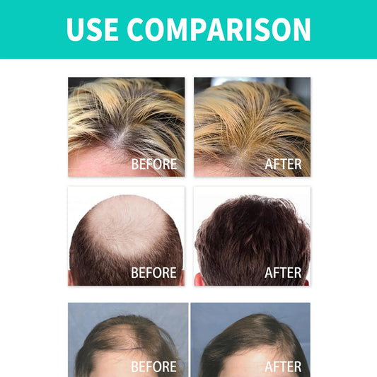 Dense Hair Thick Hair strong roots Firm Hairline