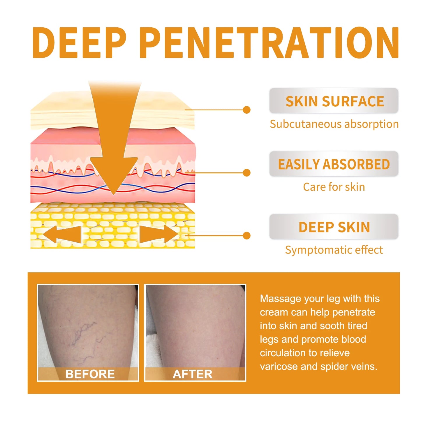 Vitamin K Cream Improve Varicose Veins.