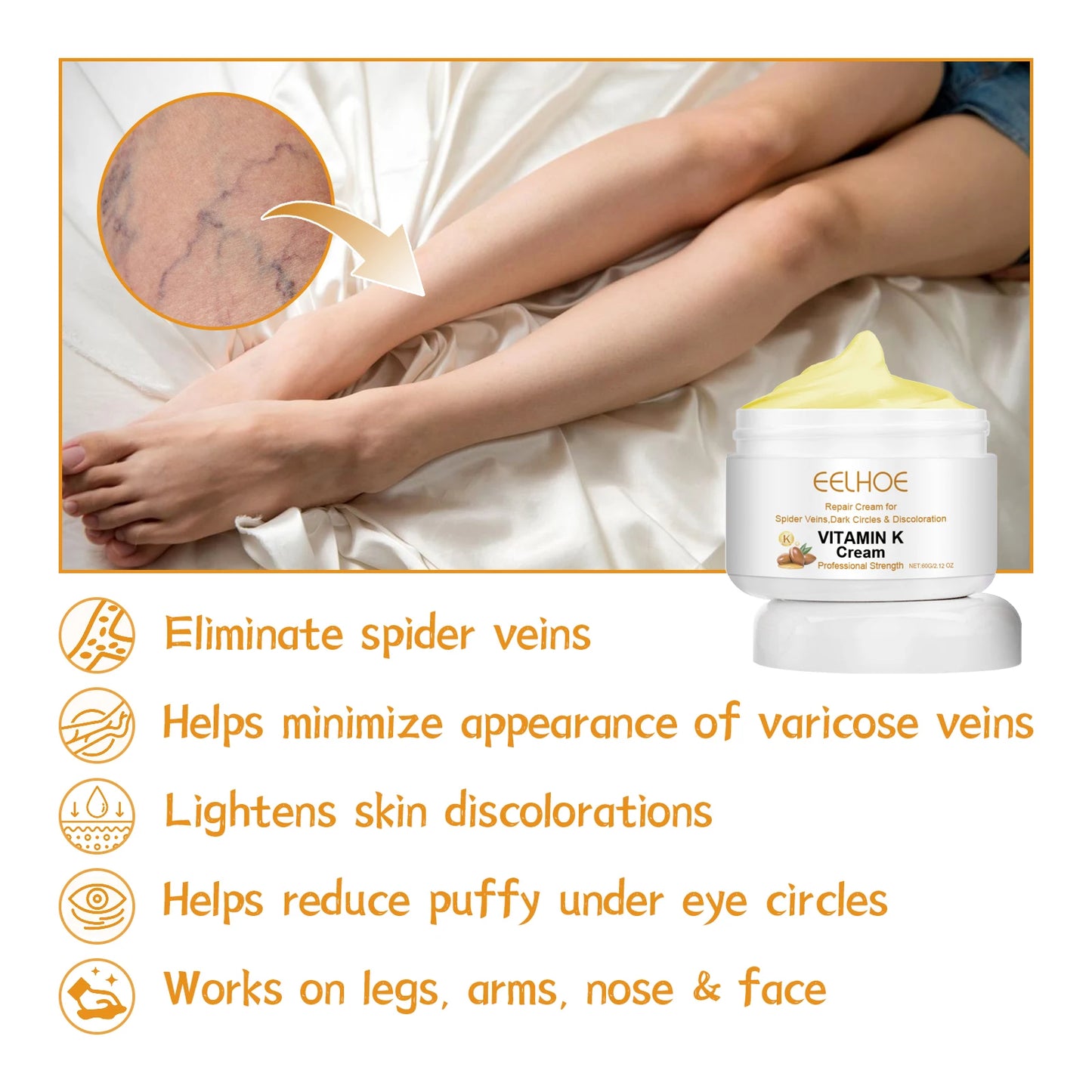 Vitamin K Cream Improve Varicose Veins.