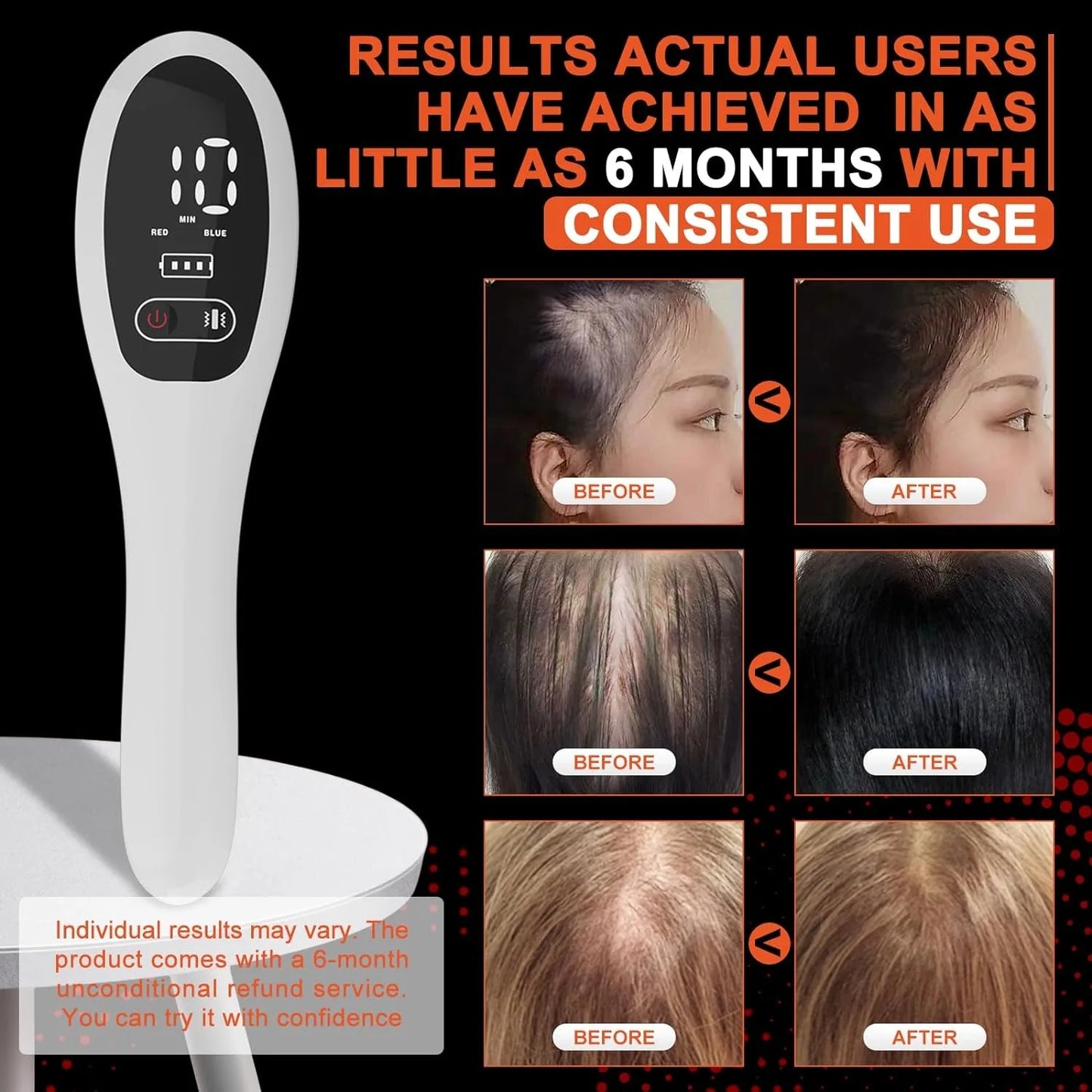 Electric Laser Hair Growth Comb.